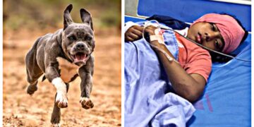 ‘पिटबुल’ डॉग ने किया बच्ची पर जानलेवा हमला, मासूम का मुंह नोचा और कान काट खाया