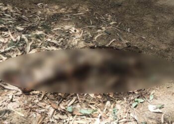 नहर किनारे मिली कटी हुई टांग, जांच में जुटी पुलिस