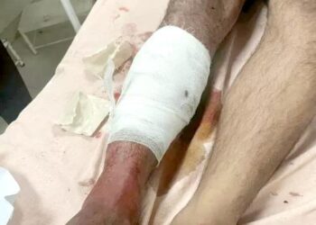 हरियाणा में युवक को घर के सामने गोली मारी:आवाज सुनकर गुस्साए लोग