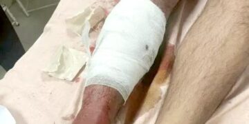 हरियाणा में युवक को घर के सामने गोली मारी:आवाज सुनकर गुस्साए लोग