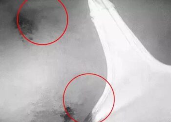 अमृतसर में नशा बेचने से रोकने पर गोलियां मारीं: ठेकेदार के कंधे पर लगीं, फायरिंग सुनकर परिवार दौड़ा आया तो खून से लथपथ मिला