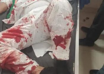 पंजाब निकाय चुनाव की वोटिंग जारी: रायकोट में कांग्रेस उम्मीदवार के हाथ-पैर तोड़े, AAP विधायक के सपोर्टर्स पर हमले का आरोप