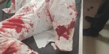 पंजाब निकाय चुनाव की वोटिंग जारी: रायकोट में कांग्रेस उम्मीदवार के हाथ-पैर तोड़े, AAP विधायक के सपोर्टर्स पर हमले का आरोप