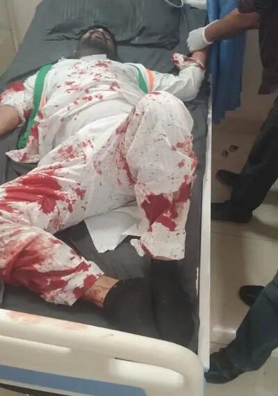पंजाब निकाय चुनाव की वोटिंग जारी: रायकोट में कांग्रेस उम्मीदवार के हाथ-पैर तोड़े, AAP विधायक के सपोर्टर्स पर हमले का आरोप